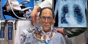 دل اور نبض کے بغیر انسانی زندگی