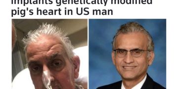 سور کے جسم کے اعضاء ہی کیوں انسان کے جسم کے متبادل اعضاء میں لگائے جارہےہیں؟